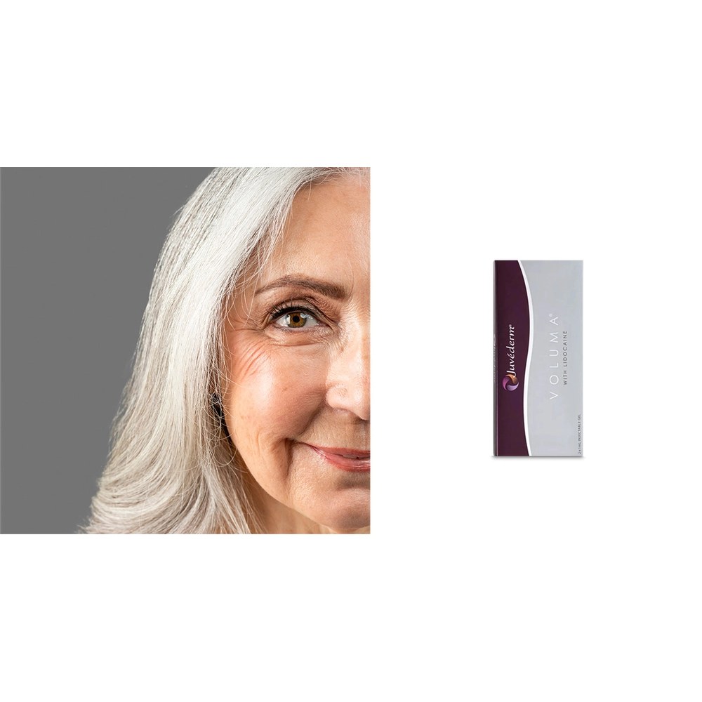 Juvederm Voluma — Cheek Volume & Lift with Vycross (2×1ml)